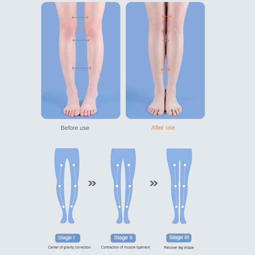PU Orthopedische Binnenzool St - Women Shoes Types recensie en prijs